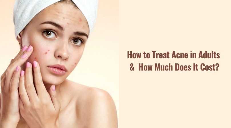 How to Treat Acne in Adults & How Much Does It Cost